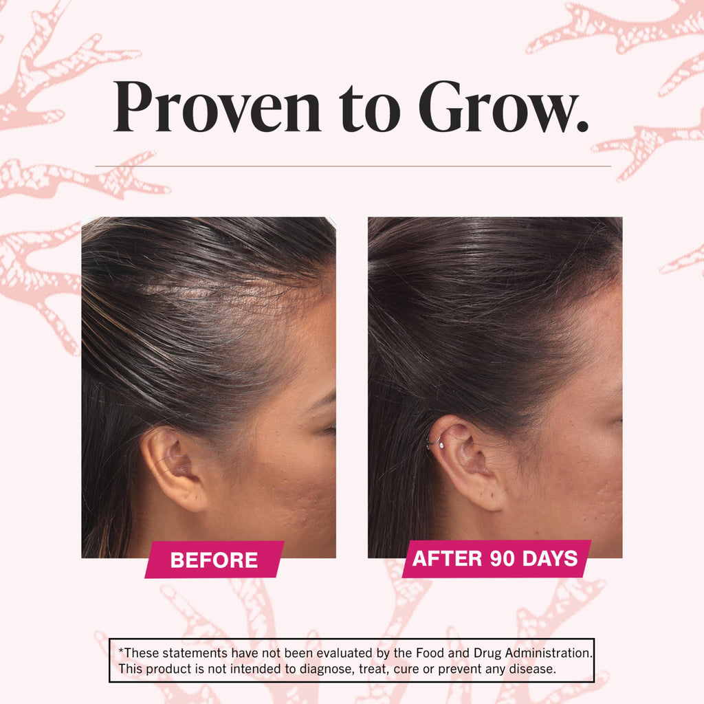 Viviscal Advanced Hair Growth Supplement – 180 tablets