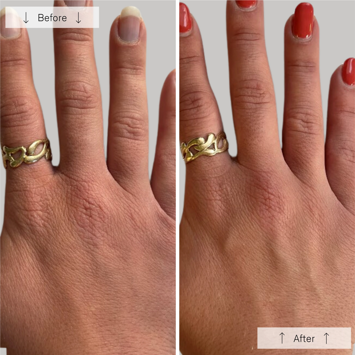 Omnilux Clear + Contour Glove Bundle